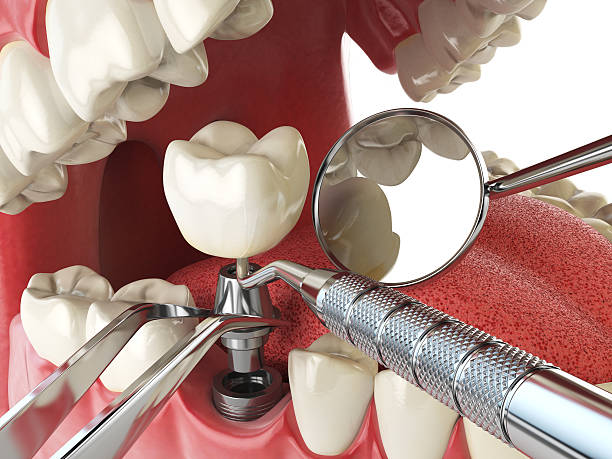 Best Emergency Cosmetic Dentistry (e.g., broken veneers) in Enterprise, WV